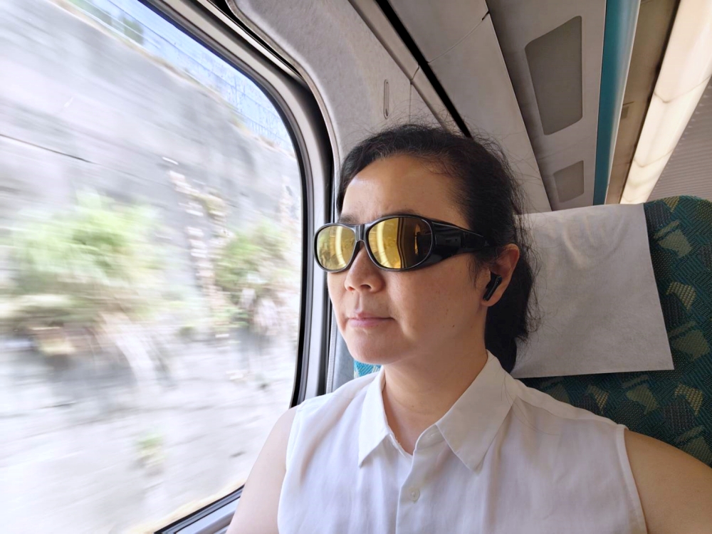 眼袋手術全記錄 | 我的眼袋終於變臥蠶！唯一後悔就是沒有更早做