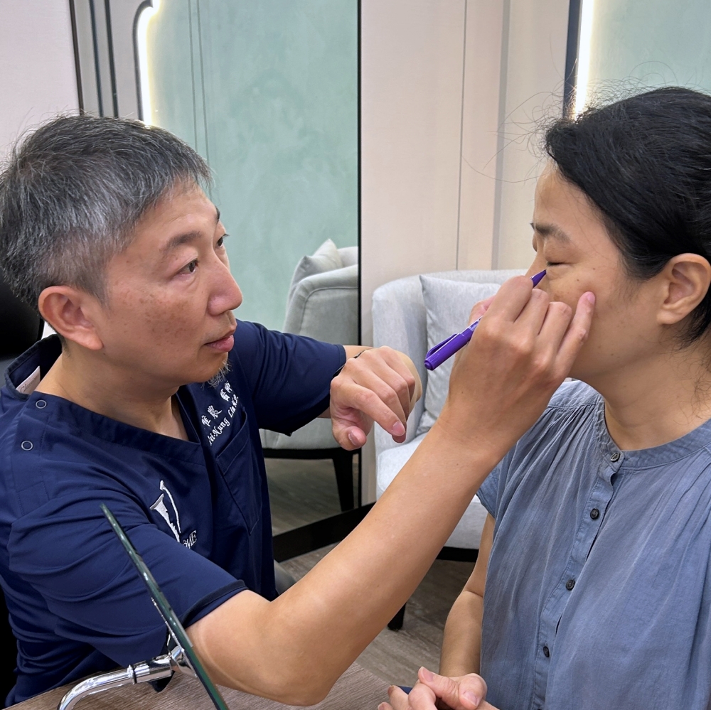 眼袋手術全記錄 | 我的眼袋終於變臥蠶！唯一後悔就是沒有更早做