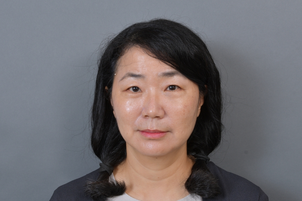 眼袋手術全記錄 | 我的眼袋終於變臥蠶！唯一後悔就是沒有更早做